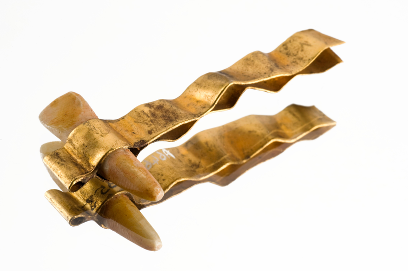 Copy of Etruscan denture, Europe